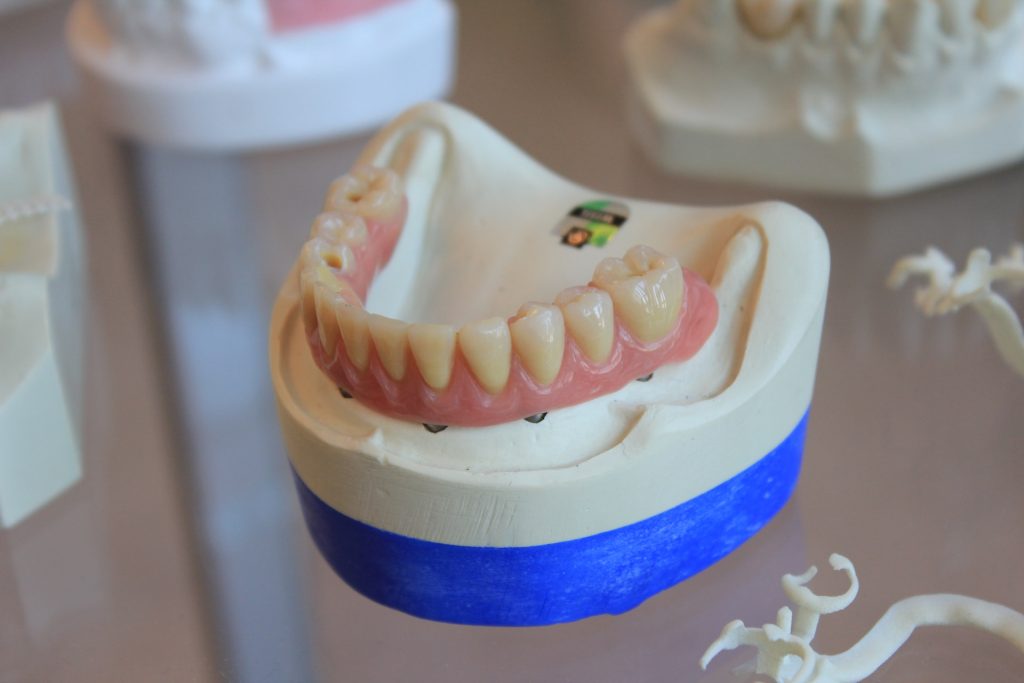 Strategies to Prevent Gum Disease